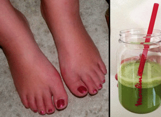 retension de líquidos